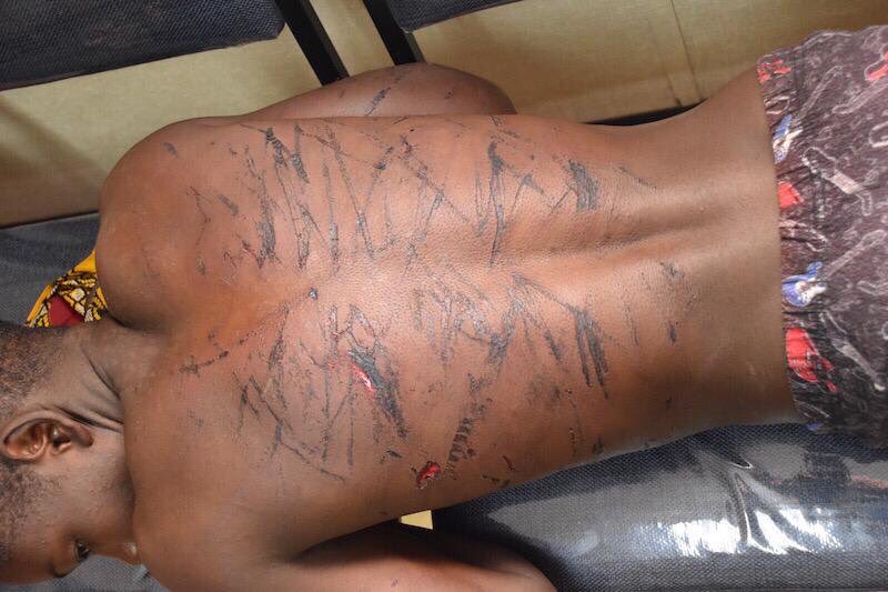 Kuwadzana Victim Of Sjamboking by Soldiers 1